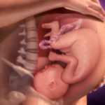 Ученые выяснили, зачем пинаются дети в утробе матери