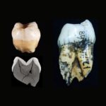 Придуман новый способ определения пола человека по образцу зуба