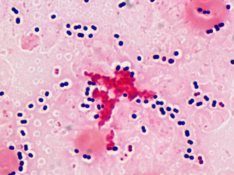 streppneumoniae1