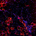 Стволовые клетки превратили в предшественников мышечной ткани