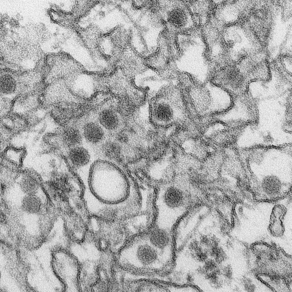 zikavirus
