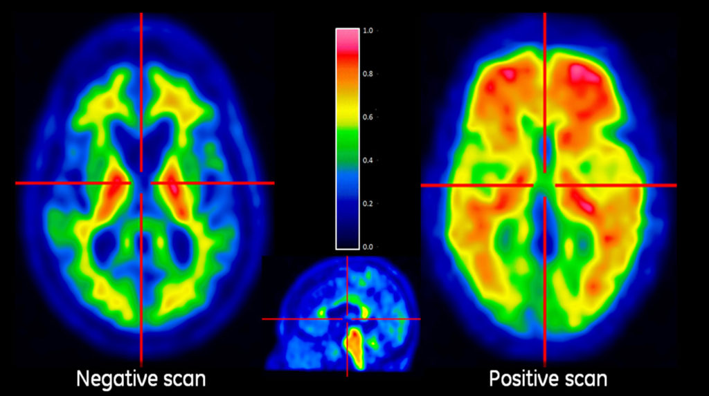 positive-and-negative1