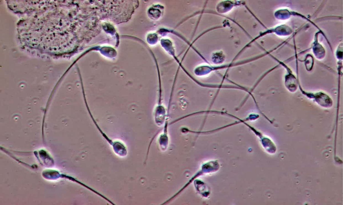 Как долго сперматозоиды могут жить в половых путях женщины
