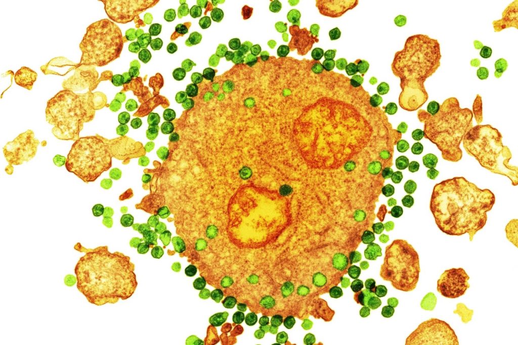 hiv0