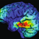 Неинвазивная стимуляция мозга улучшила рабочую память пожилых