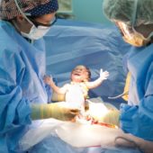 csection_gettyimages-1024x5761