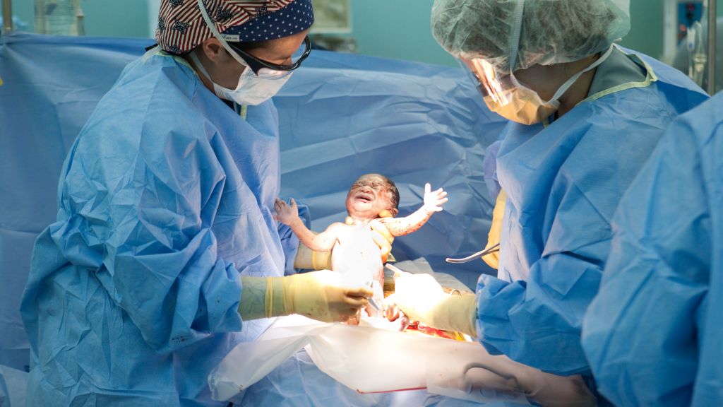csection_gettyimages-1024x5761
