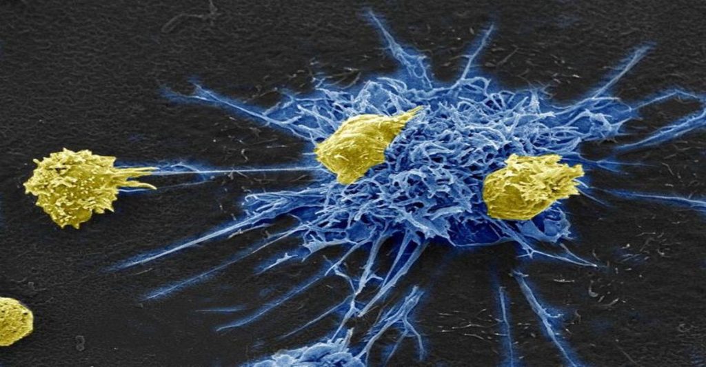 hiv20immunotherapy1