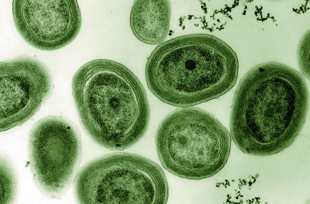 cyanobacter0