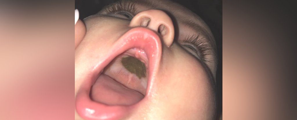 014-strange-mark-baby-mouth-1_1024