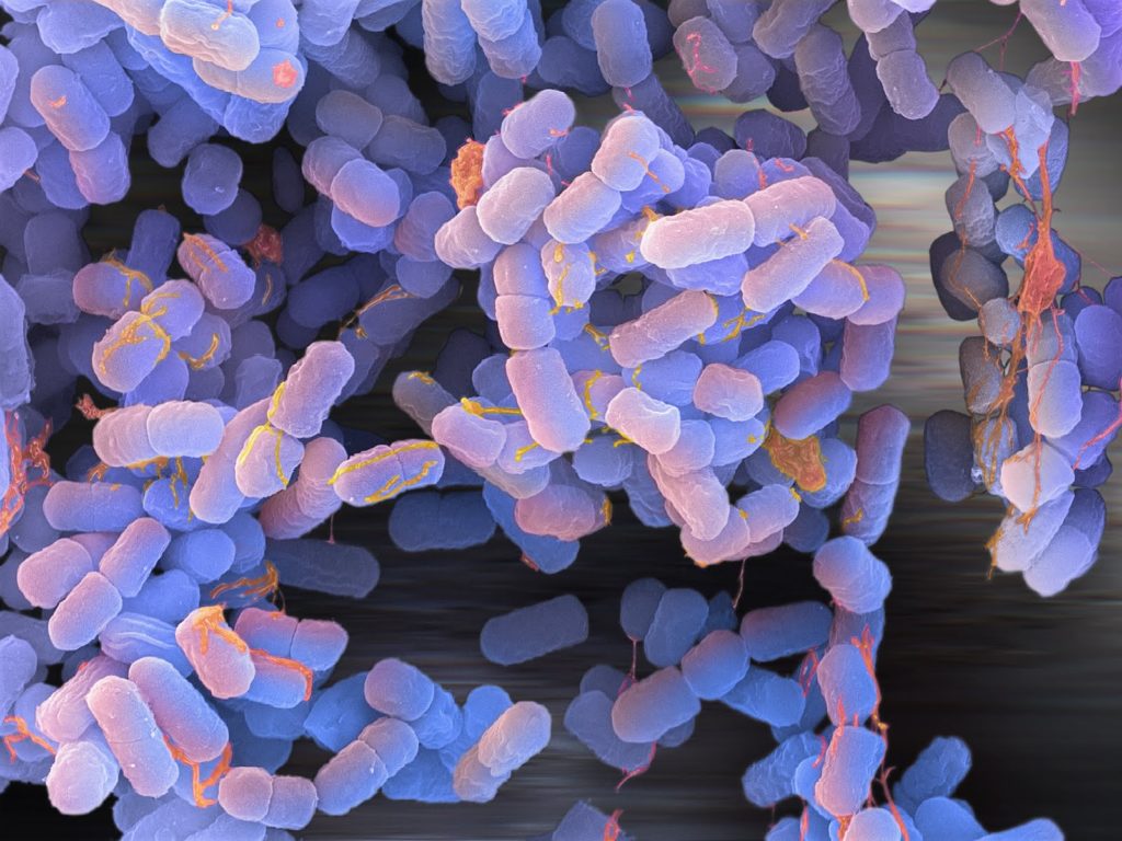 e-coli