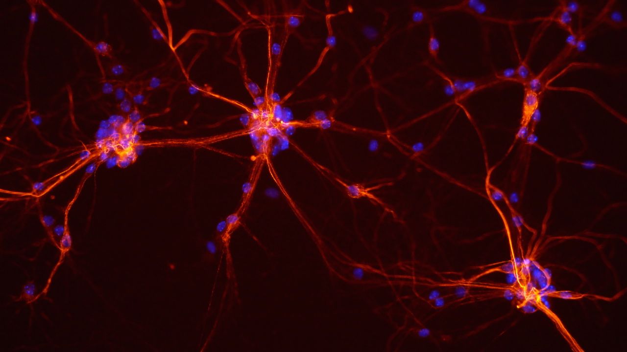neurons0