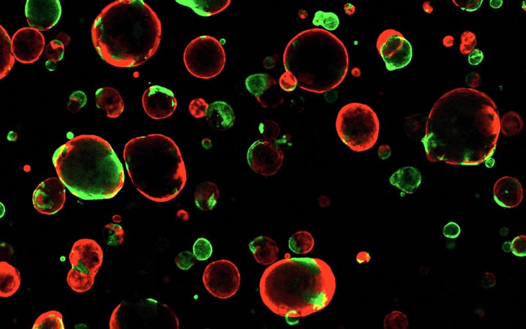 organoid0