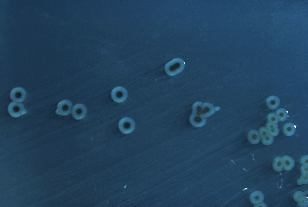 1024px-salmonella_enterica_serovar_typhimurium_01