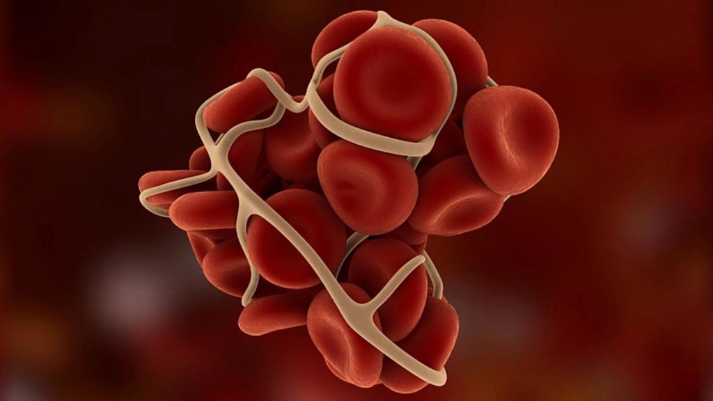 fit-thrombus