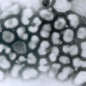 Микрофотография вируса гриппа типа А