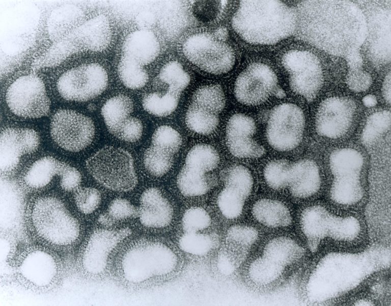 Микрофотография вируса гриппа типа А
