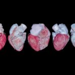 Ранние признаки сердечно-сосудистых заболеваний могут указывать на риск развития рака