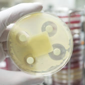 Проведение анализа на чувствительность бактерий к антибиотикам