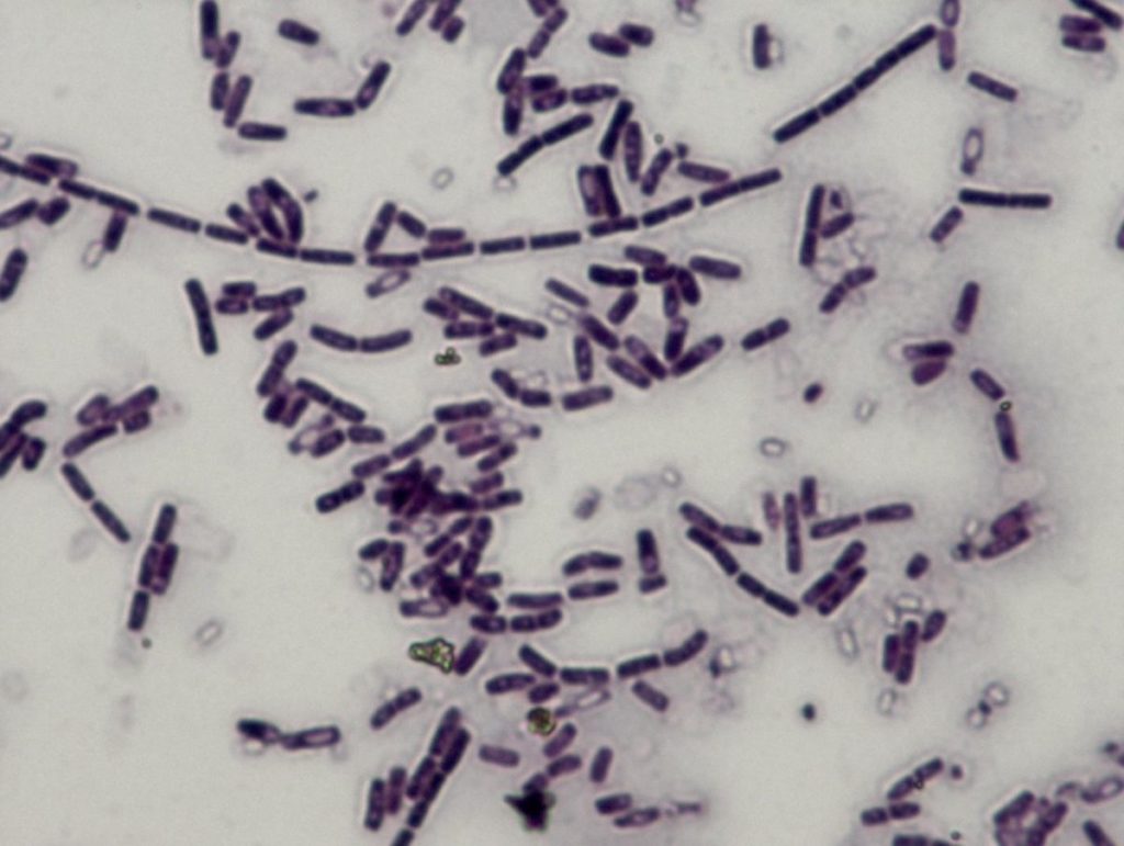 Bacillus cereus под микроскопом