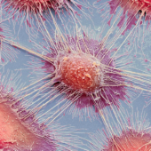 Нагреть и разрушить: ученые тестируют новые типы наночастиц для «прицельной» борьбы с раком