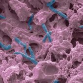 Бактерии на слизистой легких