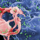 Вирусы ВИЧ (зеленые) отпочковываются от зараженного лимфоцита