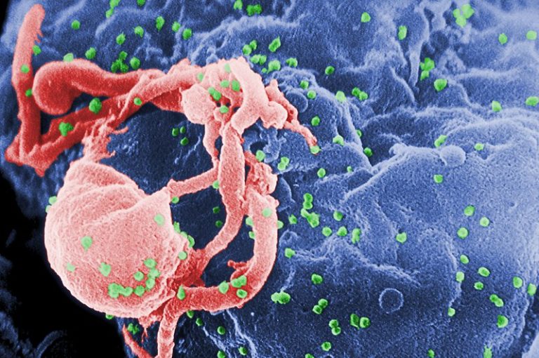 Вирусы ВИЧ (зеленые) отпочковываются от зараженного лимфоцита