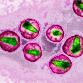 Изображение вируса иммунодефицита человека, сделанное при помощи просвечивающего электронного микроскопа