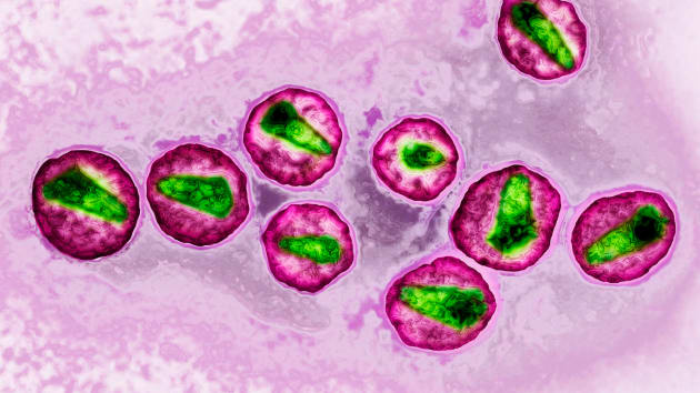 Изображение вируса иммунодефицита человека, сделанное при помощи просвечивающего электронного микроскопа