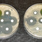 Тесты на устойчивость к антибиотикам: Бактерии высевают штрихами на чашках с белыми дисками, пропитанными антибиотиком. Чистые кольца, как на чашке слева, показывают, что бактерии не выросли — что свидетельствует об отсутствии устойчивости у этих бактерий. Бактерии на чашке справа полностью восприимчивы только к трем из семи протестированных антибиотиков