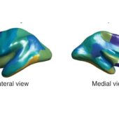 На рисунке показано, как усредняется между полушариями толщина разных участков коры головного мозга людей с РАС