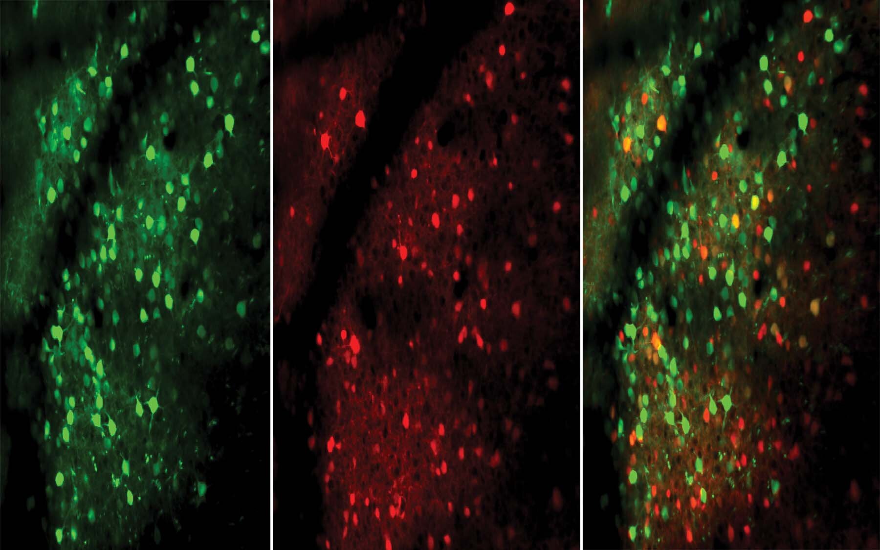 Возбуждающие (зеленые) и тормозные (красные) нейроны на микрофотографиях мышиного мозга