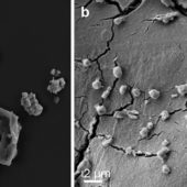 Частицы метеорита NWA 1172, на котором культивировали археи M.sedula (левая часть изображения) и клетки архей на поверхности камня (правая часть)