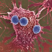 Т-лимфоциты и раковая клетка