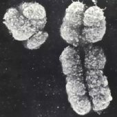 Фотография Y- и Х-хромосом. сделанная при помощи электронного микроскопа