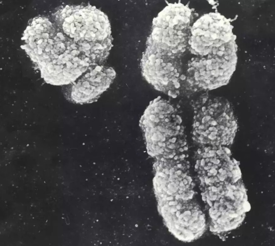 Фотография Y- и Х-хромосом. сделанная при помощи электронного микроскопа