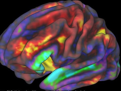 Визуализация работы мозга ребенка во время МРТ-обследования при выполнении задачи на запоминание. Красным и желтым показаны самые активные области /©ABCDSource:Supplied