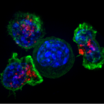 Раскрыта роль стволовых клеток в развитии смертельного рака ЖКТ