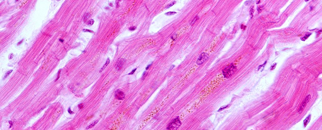 Микрофотография клеток сердечной мышцы