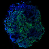 Образец колоректального рака мыши с протеинами, меченными флуоресцентными метками для отслеживания поведения стволовых раковых клеток
