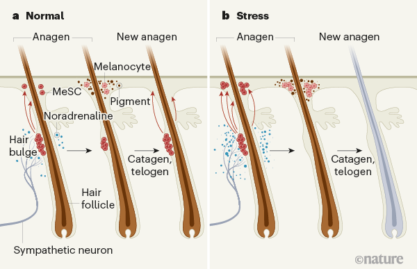 Изображение демонстрирует, как стресс влияет на меланоцитарные стволовые клетки, которые находятся в выпуклости волосяного фолликула © / Nature