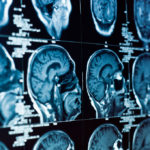 Нейросети и МРТ: молодые ученые предлагают новый подход в диагностике мозга
