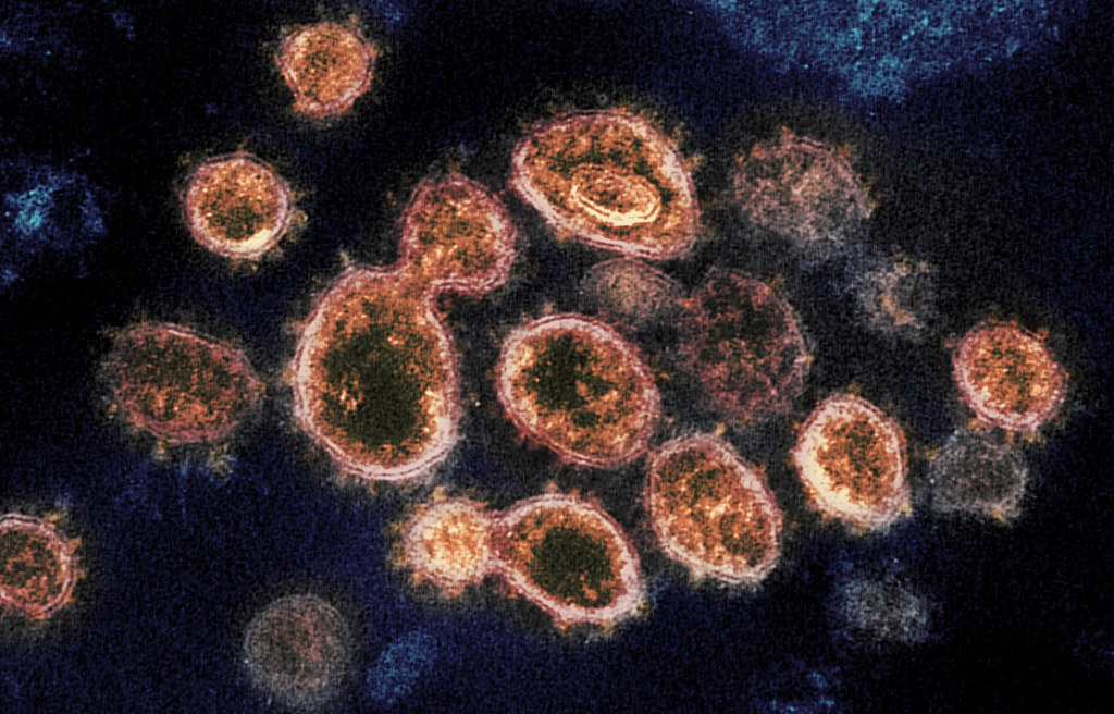 Капсиды вируса SARS-CoV-2, вызывающего Covid-19 / © NIAID-RML