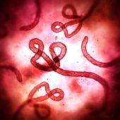 Микрофотография вирионов возбудителя лихорадки Эбола