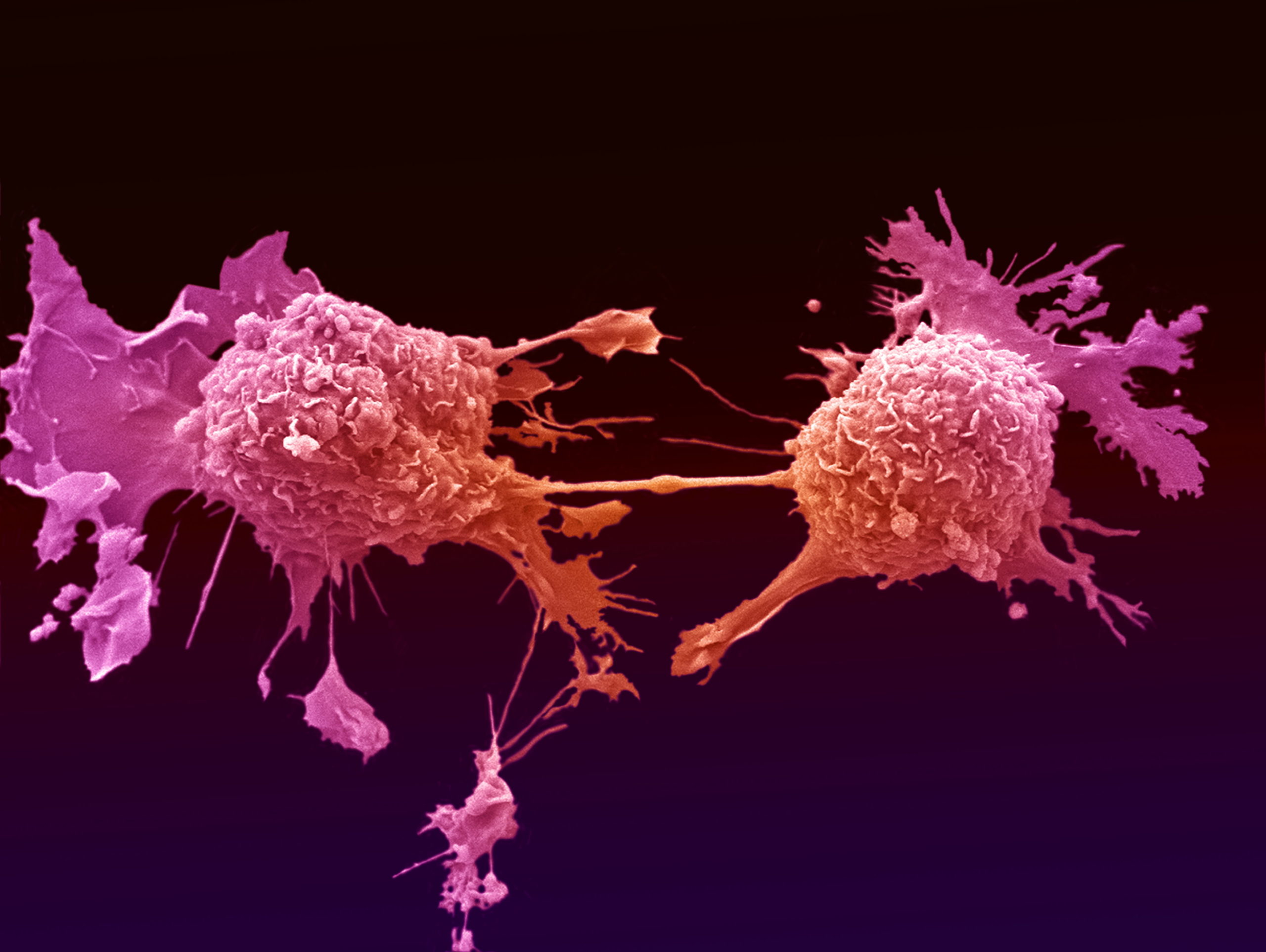 Антитела из полимеров позволят эффективно метить и уничтожать раковые клетки