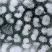 Вирус гриппа А (микрофотография)
