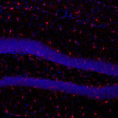 На срезе гиппокампа мыши нейроны окрашены синим, клетки микроглии – красным