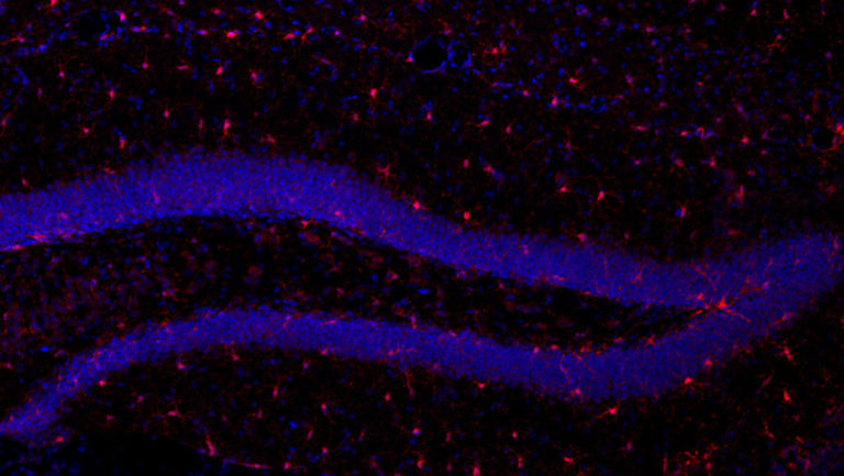 На срезе гиппокампа мыши нейроны окрашены синим, клетки микроглии – красным