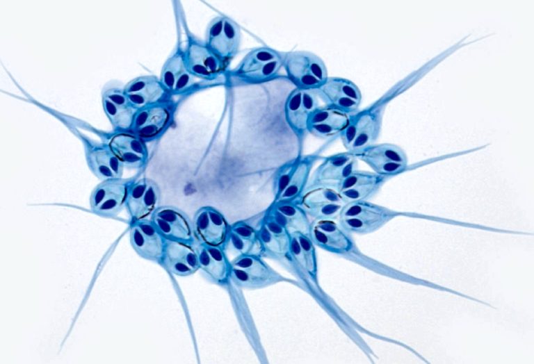 Споры Henneguya salminicola под микроскопом: видны темные капсулы стрекательных клеток